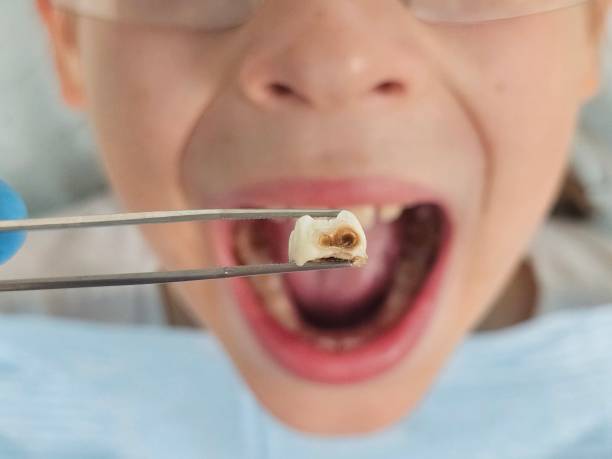 Best Teeth Whitening  in Center Line, MI